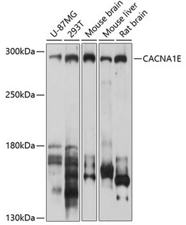 CaV2.3 Antibody in Western Blot (WB)