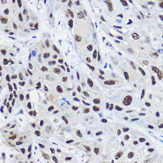 SRC2 Antibody in Immunohistochemistry (Paraffin) (IHC (P))