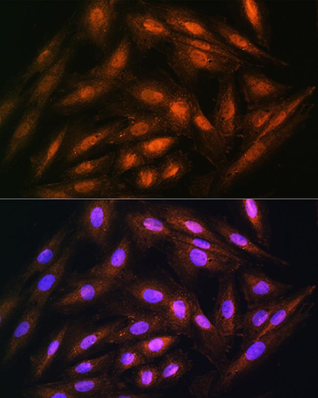 DUSP14 Antibody in Immunocytochemistry (ICC/IF)