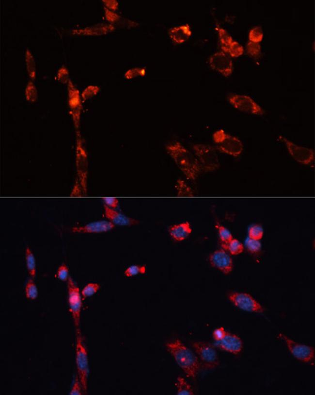 MMP16 Antibody in Immunocytochemistry (ICC/IF)