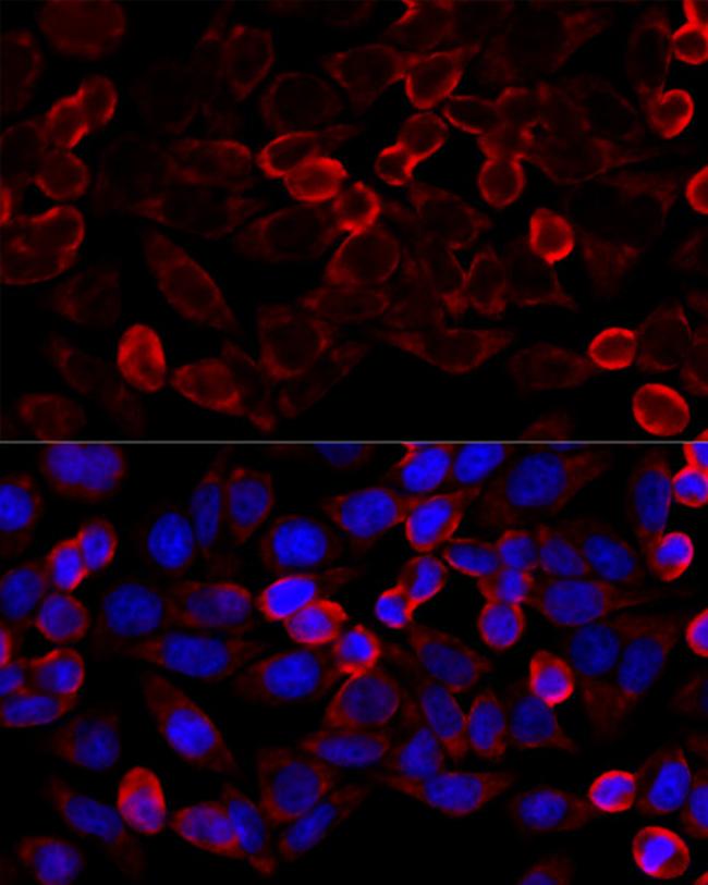 HDAC6 Antibody in Immunocytochemistry (ICC/IF)