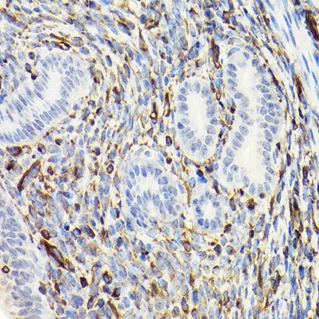 Vimentin Antibody in Immunohistochemistry (Paraffin) (IHC (P))