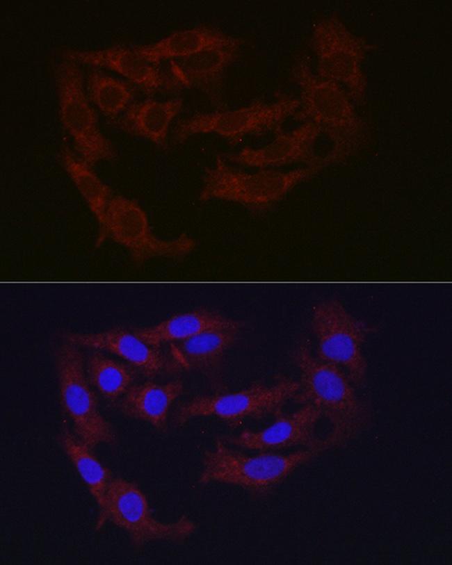 Ferritin Heavy Chain Antibody in Immunocytochemistry (ICC/IF)