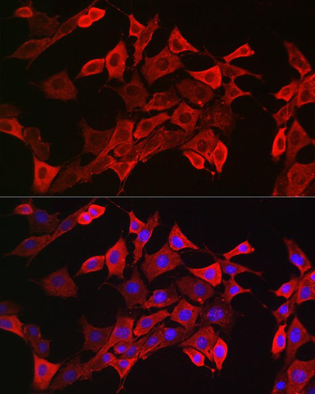 STAT3 Antibody in Immunocytochemistry (ICC/IF)