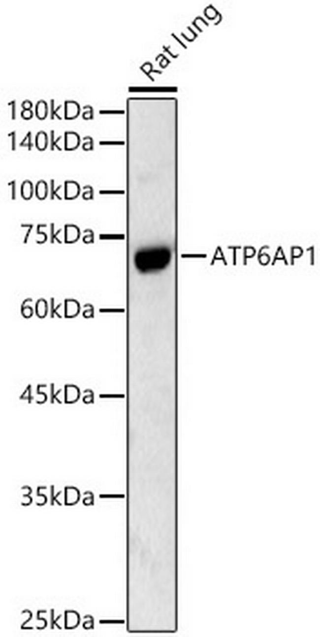 ATP6AP1 Antibody in Western Blot (WB)