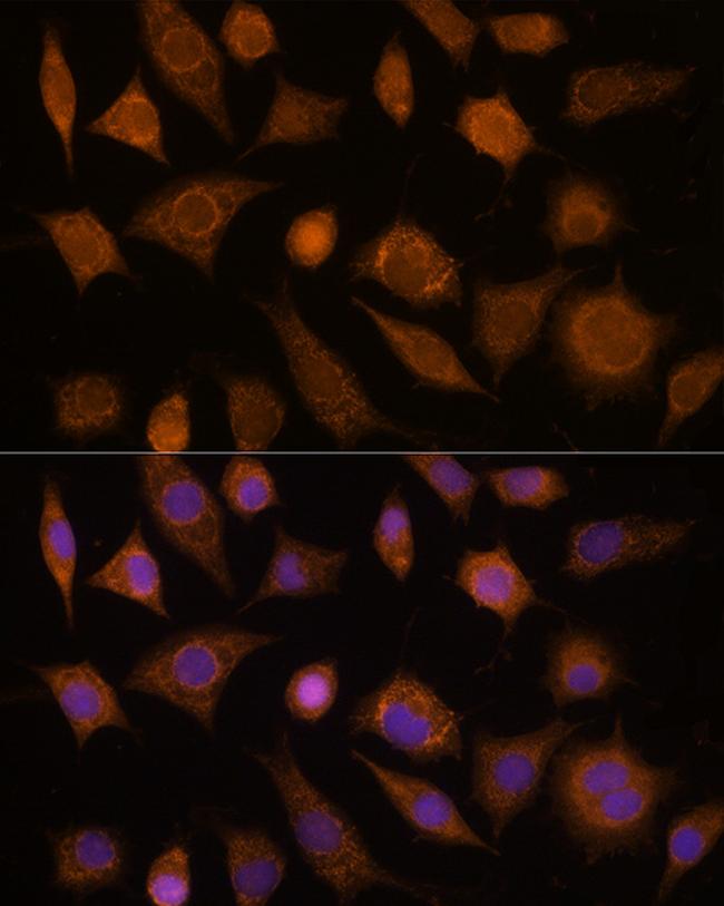 CDC20 Antibody in Immunocytochemistry (ICC/IF)