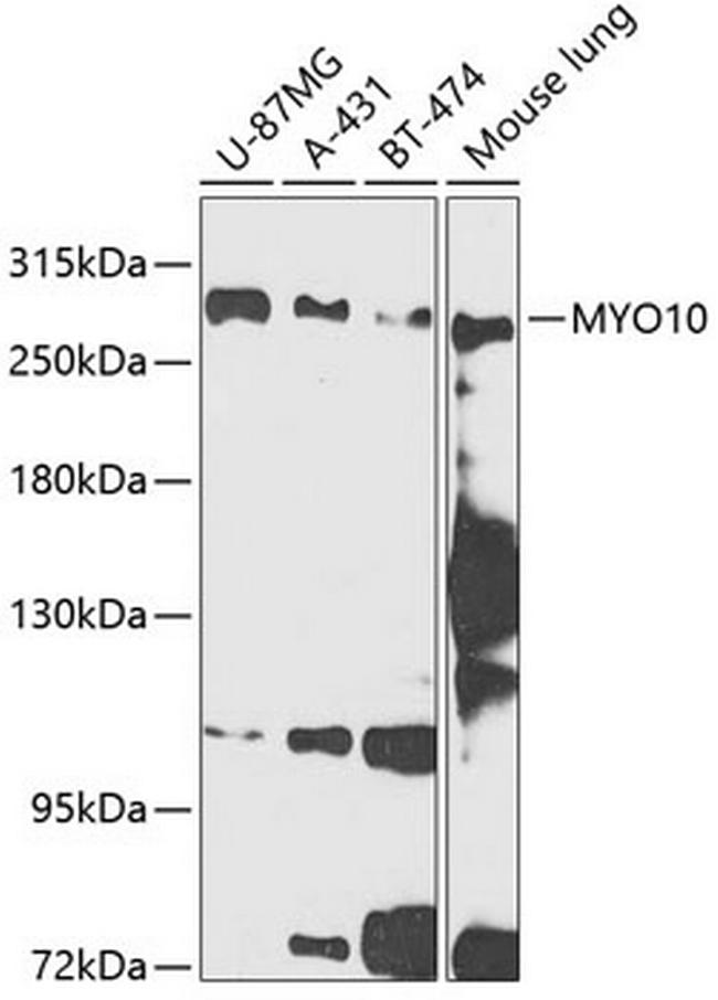 MYO10 Antibody in Western Blot (WB)