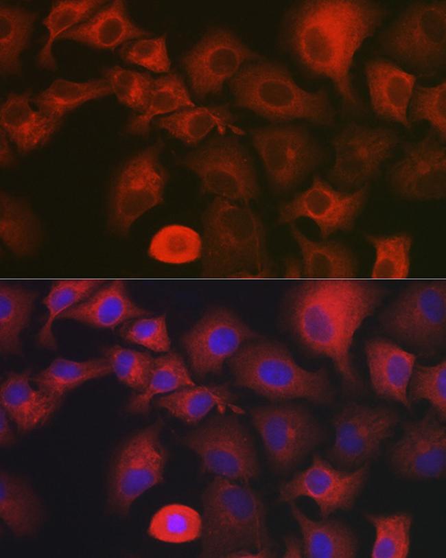 MYO10 Antibody in Immunocytochemistry (ICC/IF)