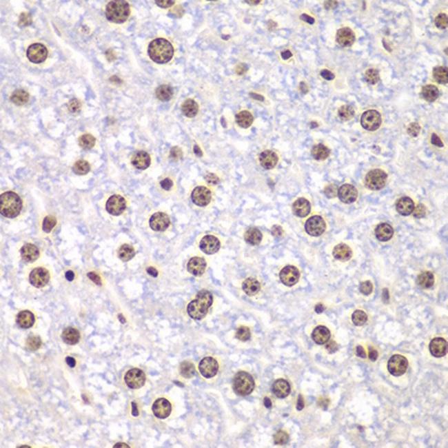 TOP1 Antibody in Immunohistochemistry (Paraffin) (IHC (P))