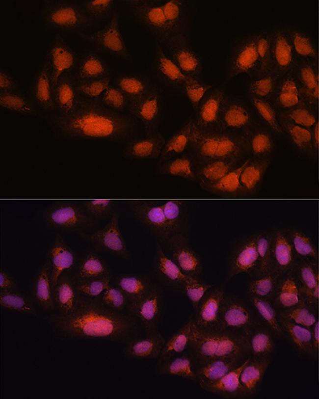 MAD2L2 Antibody in Immunocytochemistry (ICC/IF)