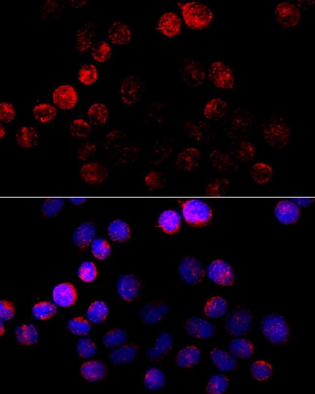 Aromatase Antibody in Immunocytochemistry (ICC/IF)