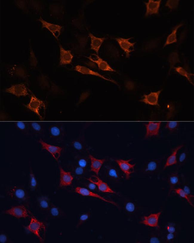 HSP70 Antibody in Immunocytochemistry (ICC/IF)