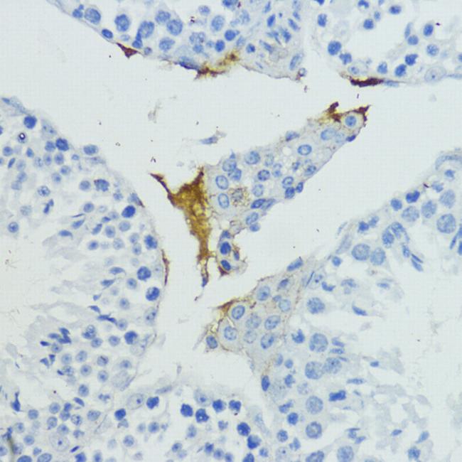 Plasma Kallikrein Antibody in Immunohistochemistry (Paraffin) (IHC (P))