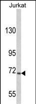 USP19 Antibody in Western Blot (WB)