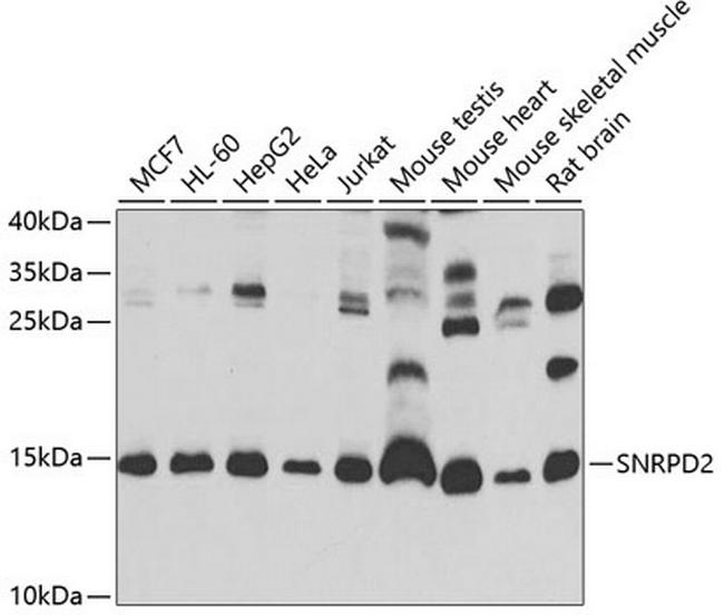 SNRPD2 Antibody in Western Blot (WB)