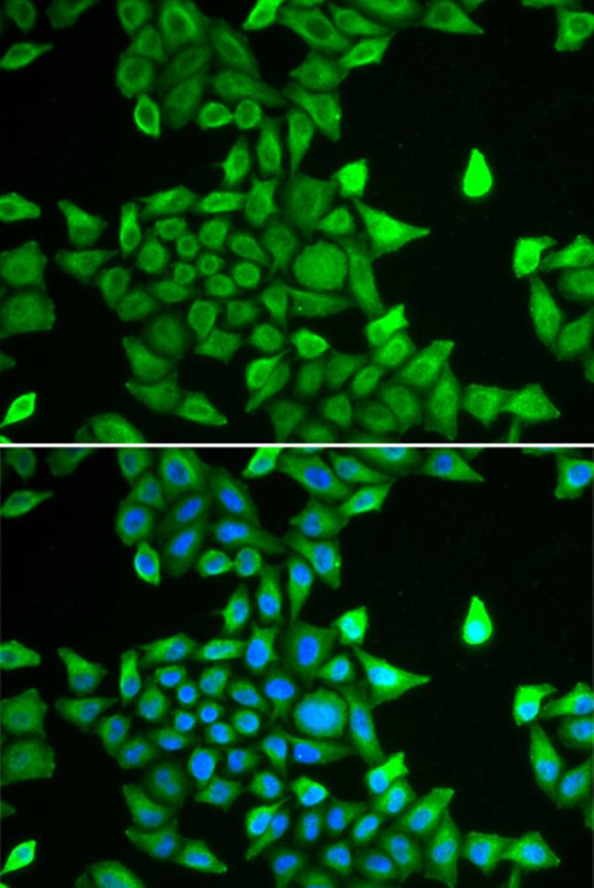 PSMA6 Antibody in Immunocytochemistry (ICC/IF)