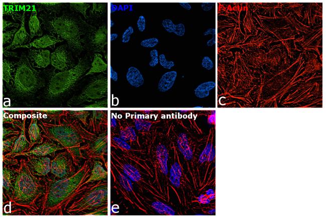 TRIM21 Antibody in Immunocytochemistry (ICC/IF)