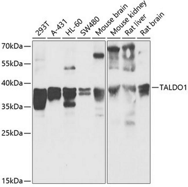 TALDO1 Antibody in Western Blot (WB)