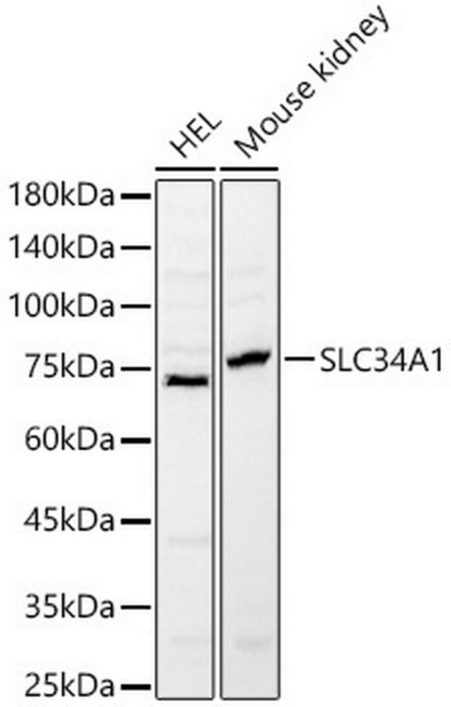 SLC34A1 Antibody in Western Blot (WB)