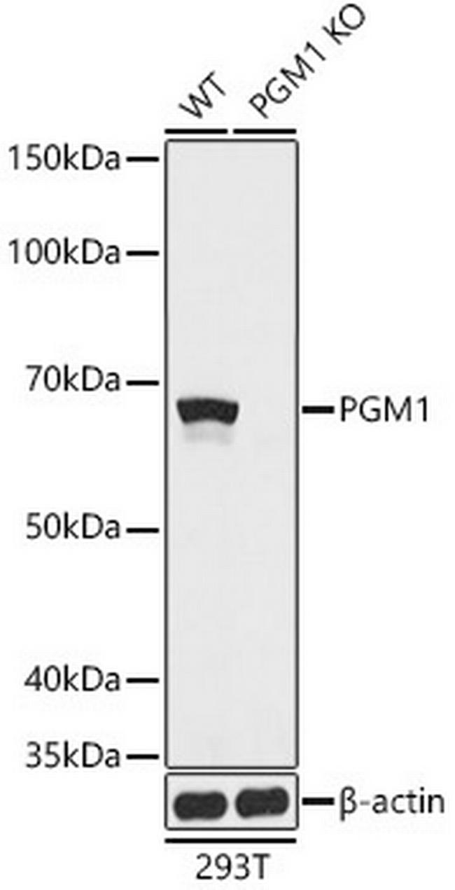 PGM1 Antibody in Western Blot (WB)