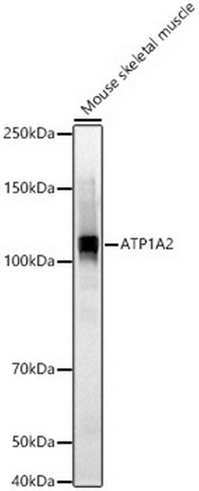 ATP1A2 Antibody in Western Blot (WB)