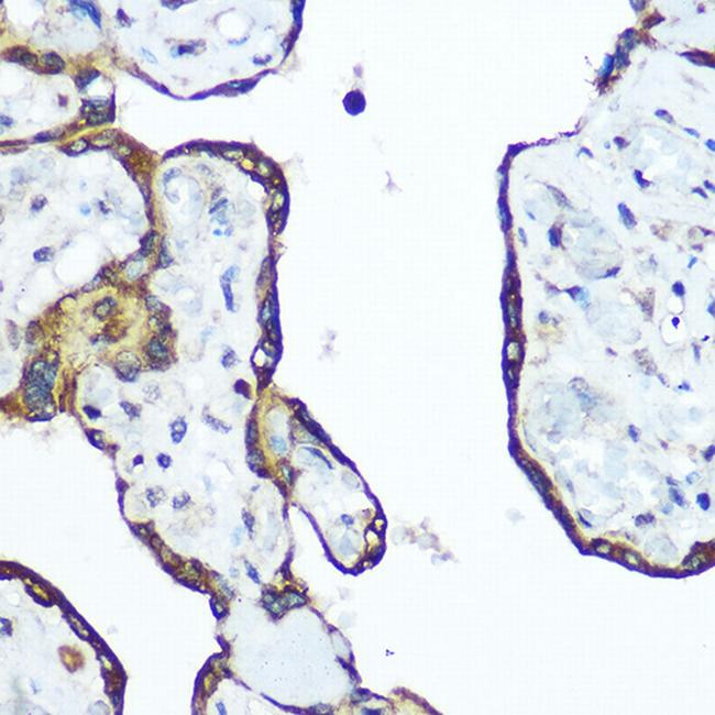 RhoA Antibody in Immunohistochemistry (Paraffin) (IHC (P))