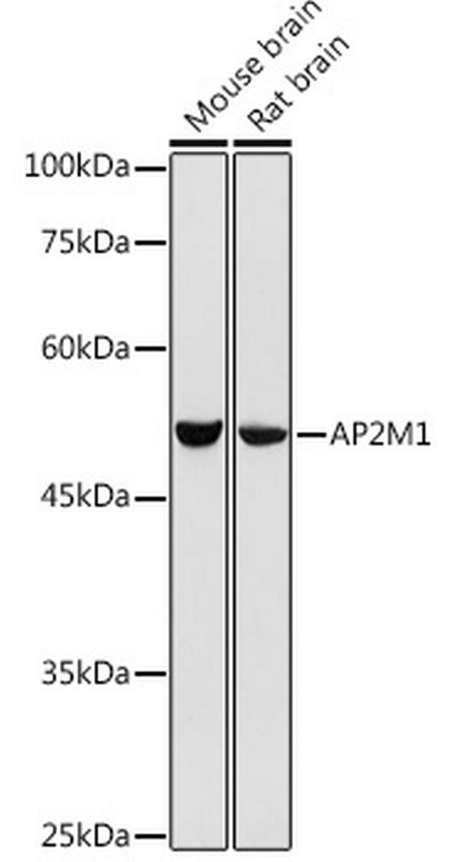 AP2M1 Antibody in Western Blot (WB)