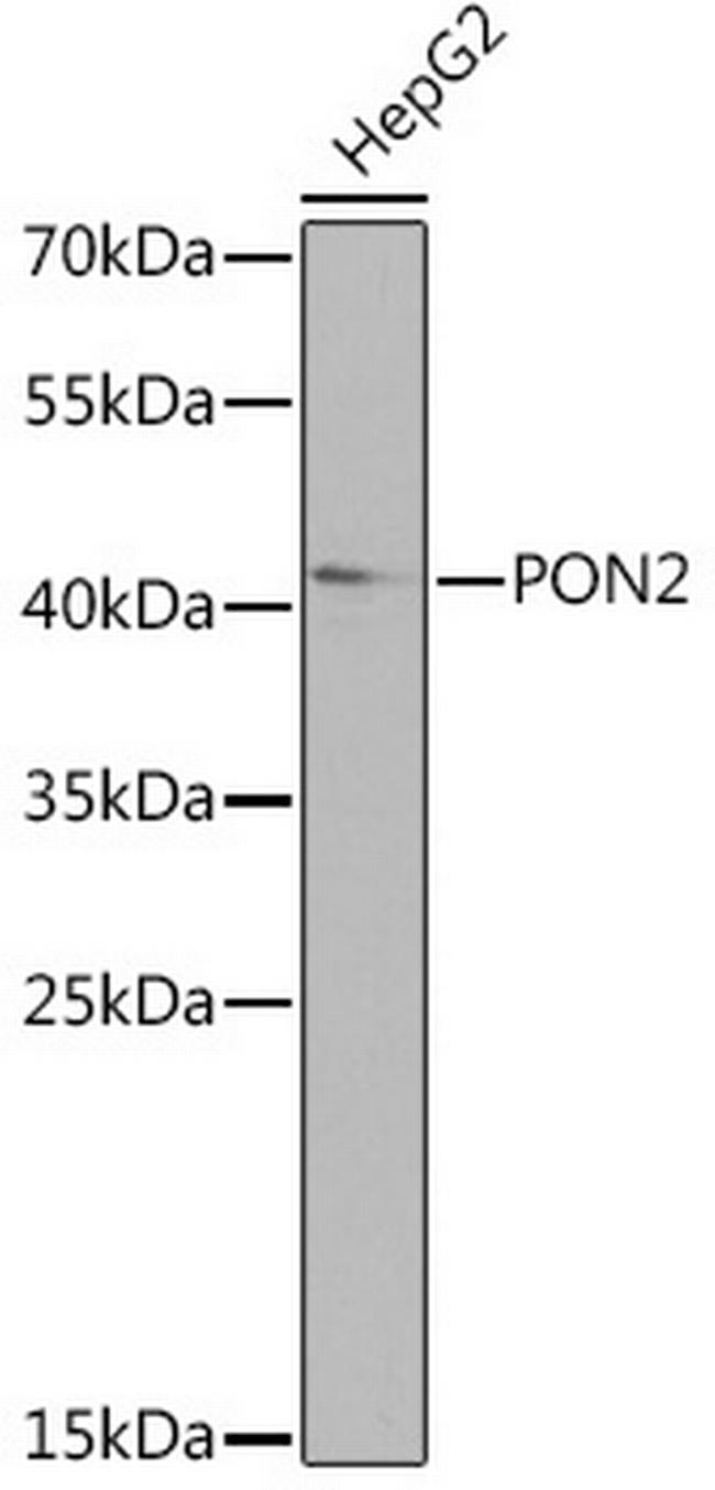 PON2 Antibody in Western Blot (WB)