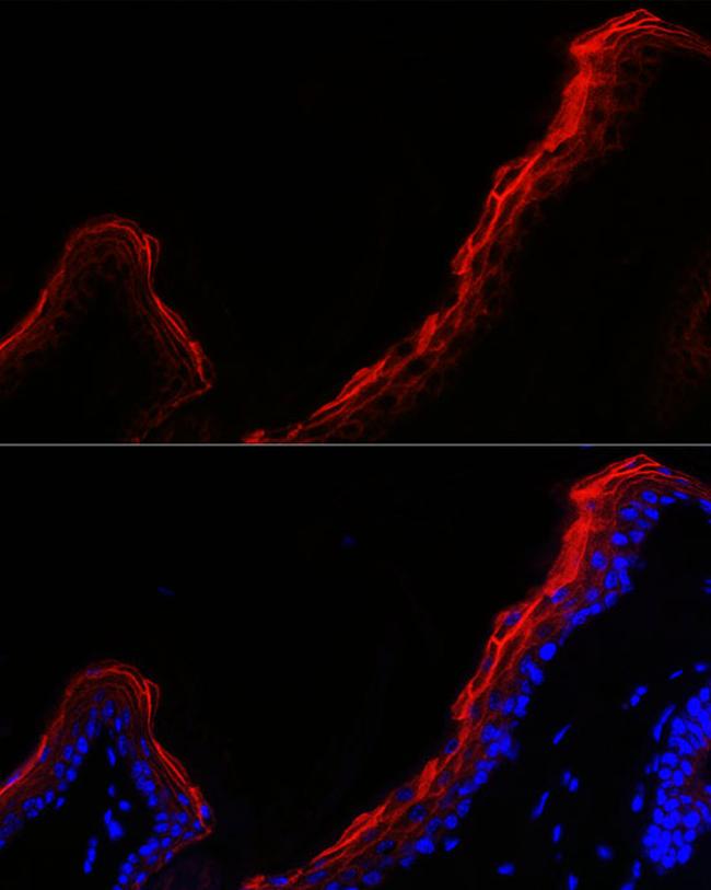 Periplakin Antibody in Immunocytochemistry (ICC/IF)