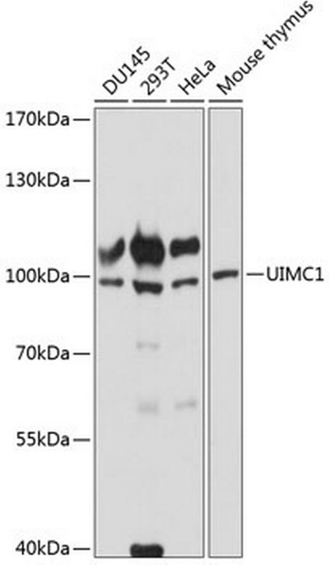 RAP80 Antibody in Western Blot (WB)