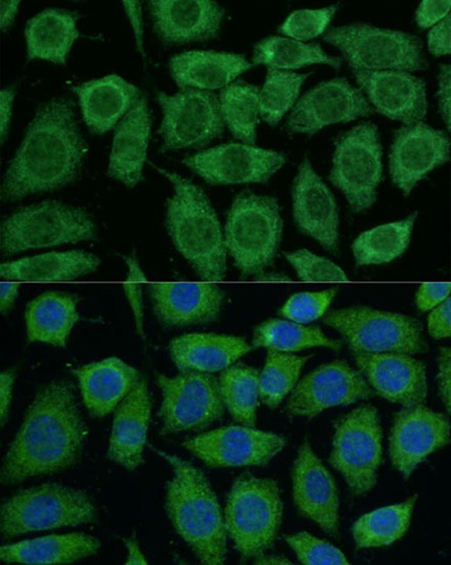 DLAT Antibody in Immunocytochemistry (ICC/IF)