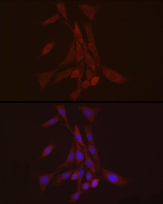 S100A10 Antibody in Immunocytochemistry (ICC/IF)