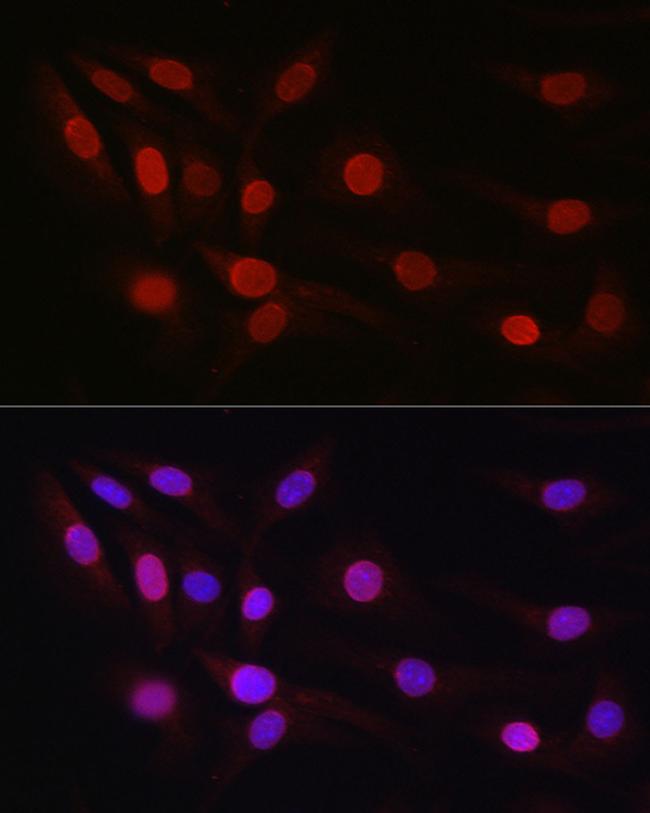 SP1 Antibody in Immunocytochemistry (ICC/IF)