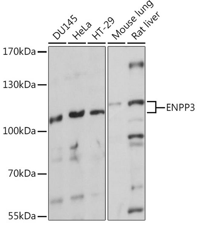 CD203c Antibody in Western Blot (WB)