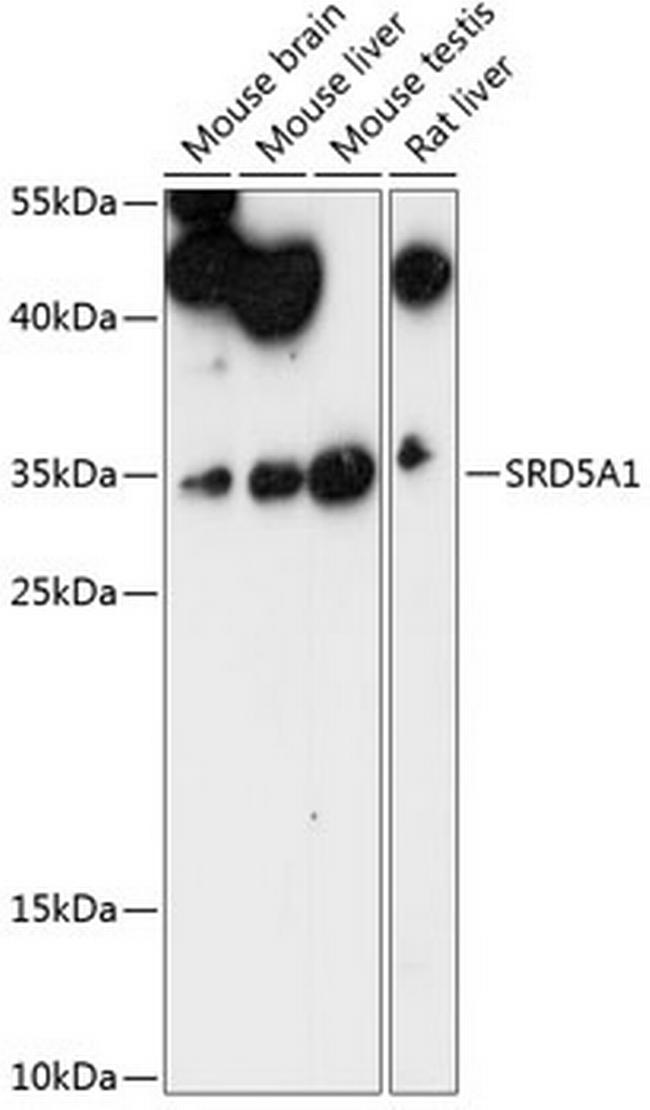 SRD5A1 Antibody in Western Blot (WB)