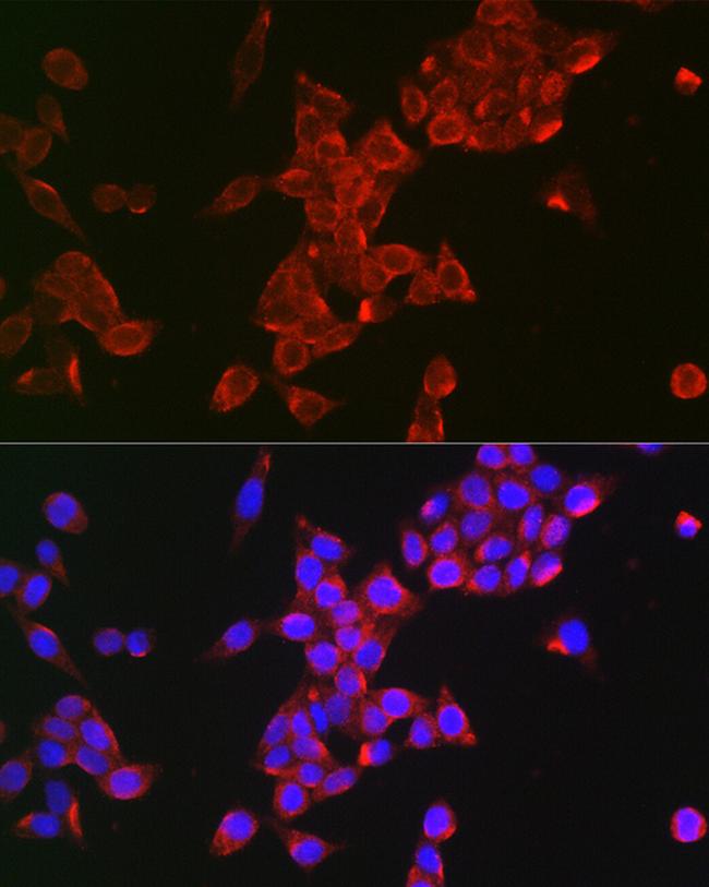 FSHR Antibody in Immunocytochemistry (ICC/IF)