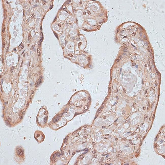 TLK1 Antibody in Immunohistochemistry (Paraffin) (IHC (P))