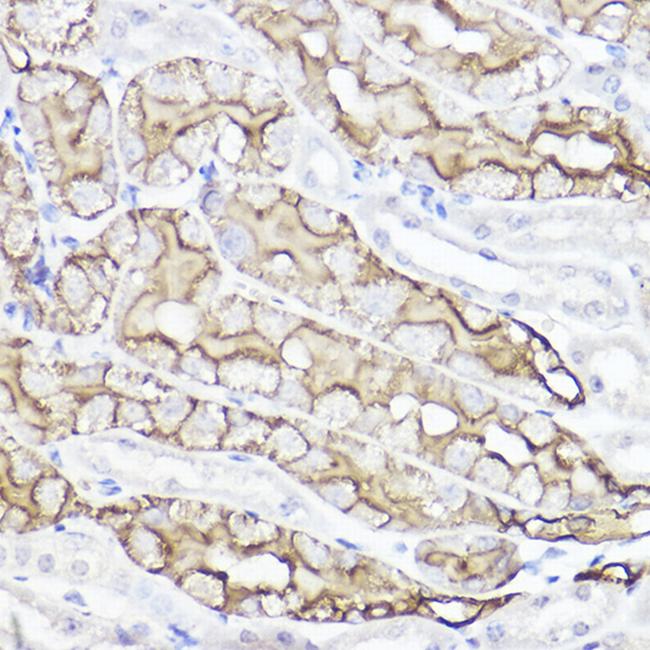 Aquaporin 1 Antibody in Immunohistochemistry (Paraffin) (IHC (P))