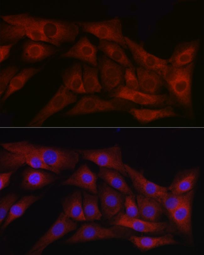 TGF beta-1 Antibody in Immunocytochemistry (ICC/IF)