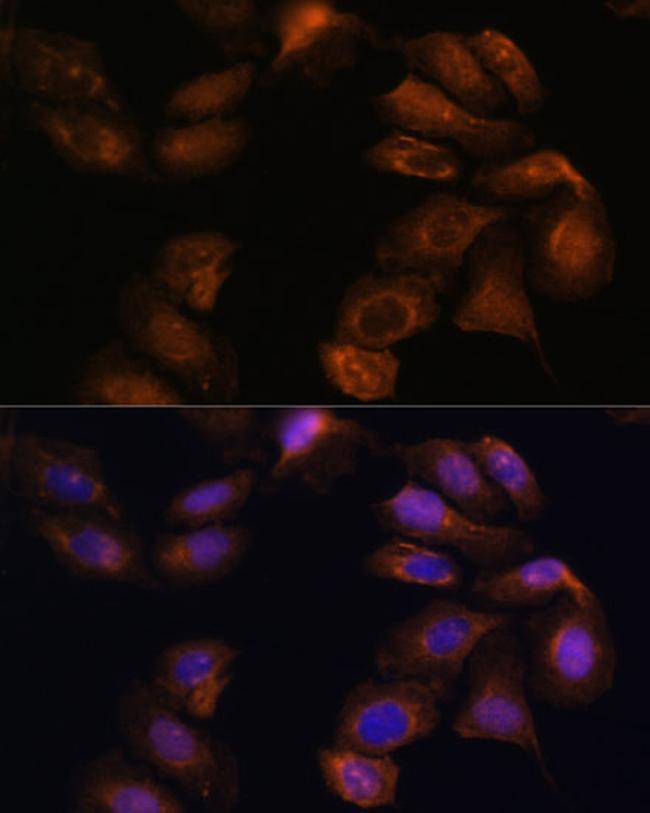 ROBO1 Antibody in Immunocytochemistry (ICC/IF)