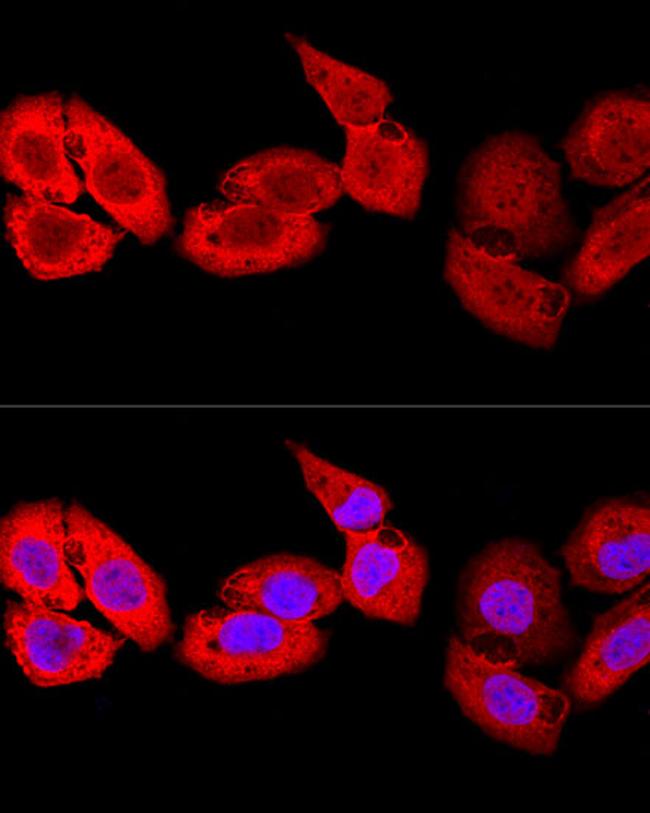 S100A8 Antibody in Immunocytochemistry (ICC/IF)