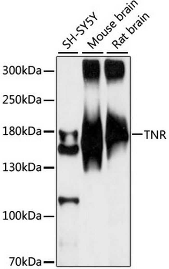 Tenascin R Antibody in Western Blot (WB)