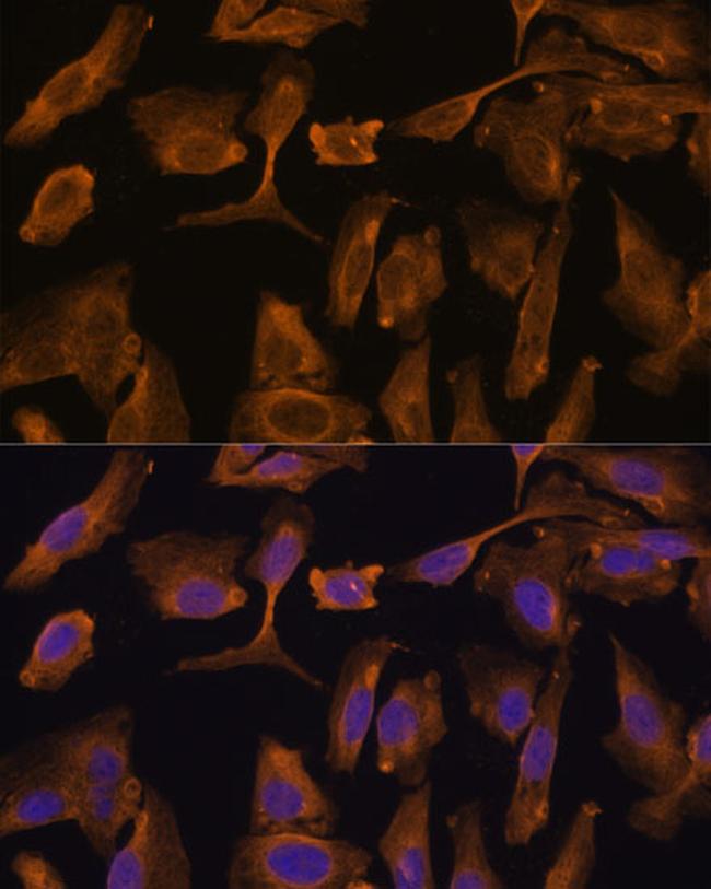 MTMR4 Antibody in Immunocytochemistry (ICC/IF)