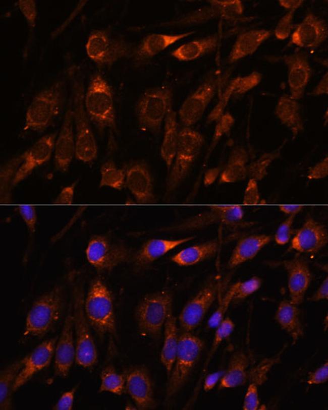 FARSB Antibody in Immunocytochemistry (ICC/IF)