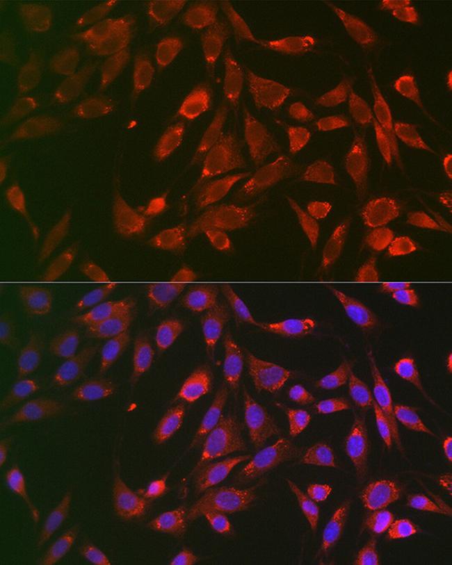 TNFR1 Antibody in Immunocytochemistry (ICC/IF)