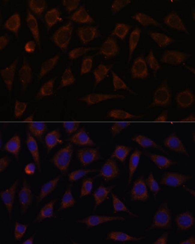 VILL Antibody in Immunocytochemistry (ICC/IF)