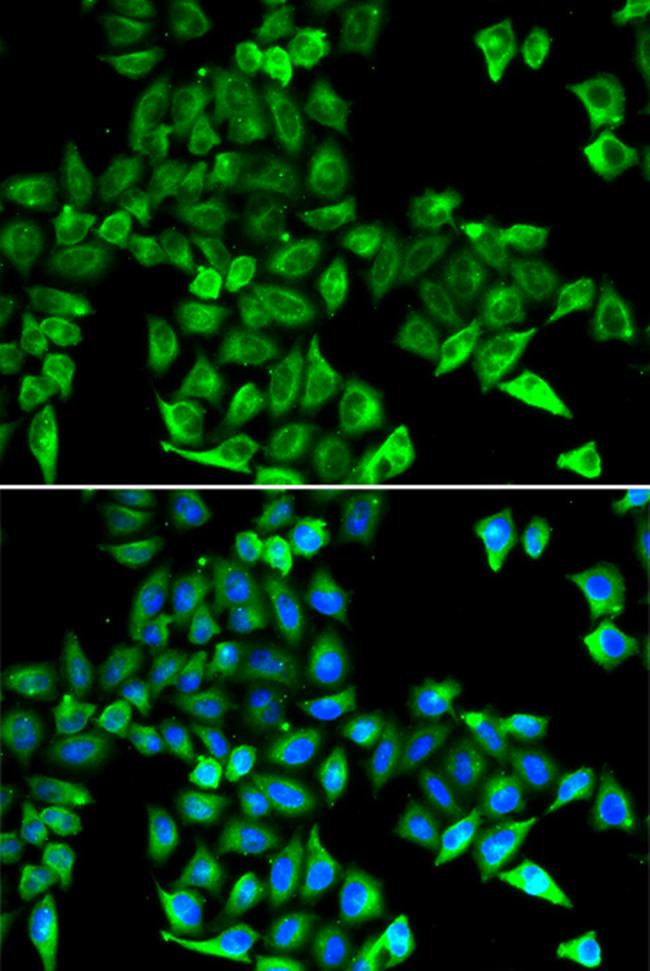 Cystatin C Antibody in Immunocytochemistry (ICC/IF)