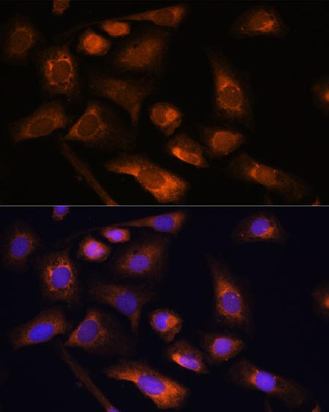 RPS13 Antibody in Immunocytochemistry (ICC/IF)