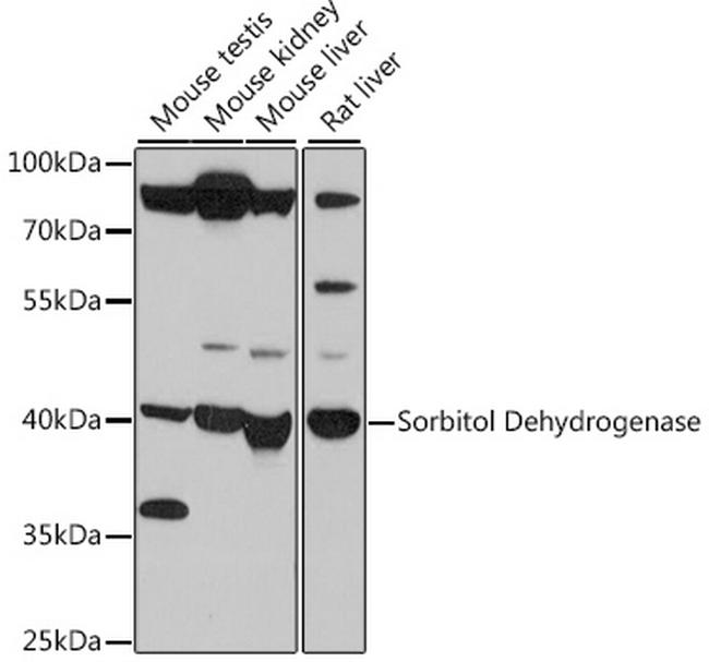 Sorbitol Dehydrogenase Antibody in Western Blot (WB)