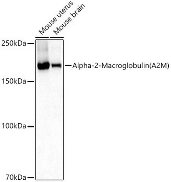 A2M Antibody in Western Blot (WB)